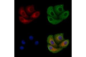 ABIN6257649 and ABIN6275602 staining Hela cells by IF/ICC. (Sorting Nexin 4 Antikörper  (Internal Region))