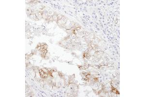Immunohistochemistry (IHC) image for anti-Solute Carrier Family 3 (Activators of Dibasic and Neutral Amino Acid Transport), Member 2 (SLC3A2) (AA 580-630) antibody (ABIN7454580)