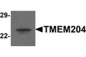 Western blot analysis of TMEM204 in human brain tissue lysate with TMEM204 antibody at 1 μg/ml.