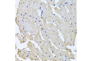Immunohistochemistry of paraffin-embedded rat heart using GPLD1 antibody (ABIN5973975) at dilution of 1/100 (40x lens). (GPLD1 Antikörper)