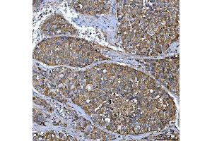 IHC analysis of FRY using anti-FRY antibody (ABIN7599716). (FRY Antikörper  (AA 11-3013))