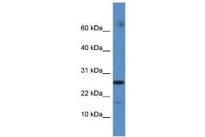 FAM36A antibody used at 1 ug/ml to detect target protein. (FAM36A Antikörper  (Middle Region))