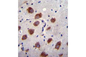 BR1B Antibody (Center) (ABIN655973 and ABIN2845358) immunohistochemistry analysis in formalin fixed and paraffin embedded human brain tissue followed by peroxidase conjugation of the secondary antibody and DAB staining. (BMPR1B Antikörper  (AA 134-162))