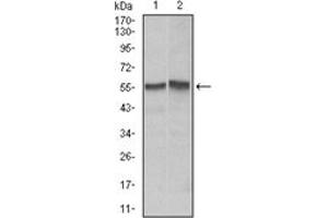 Western Blotting (WB) image for anti-TNF Receptor Superfamily, Member 6 (FAS) antibody (ABIN1106617)