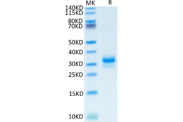 TFPI2 Protein (AA 23-213) (His tag)