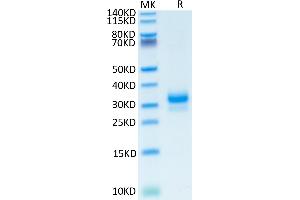Human TFPI-2 on Tris-Bis PAGE under reduced condition. (TFPI2 Protein (AA 23-213) (His tag))