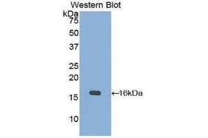 Western Blotting (WB) image for anti-Keratin 15 (KRT15) (AA 274-399) antibody (ABIN1859574) (KRT15 Antikörper  (AA 274-399))