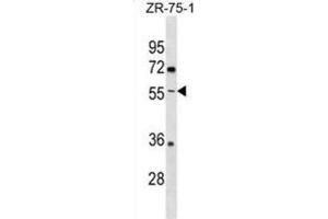 Western Blotting (WB) image for anti-Ectonucleoside Triphosphate diphosphohydrolase 5 (ENTPD5) antibody (ABIN3000843) (ENTPD5 Antikörper)