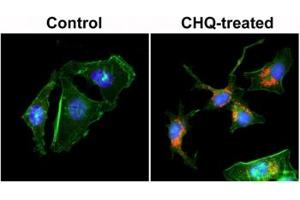 ICC staining of human HeLa cells untreated or treated with chloroquine (CHQ), with recombinant LC3B antibody (red) at 1:200 dilution. (Rekombinanter LC3B Antikörper  (N-Term))