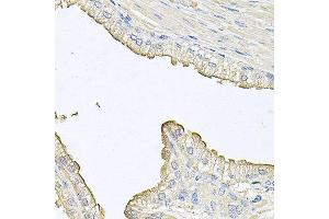Immunohistochemistry of paraffin-embedded human prostate using FABP12 antibody at dilution of 1:100 (x40 lens). (FABP12 Antikörper)