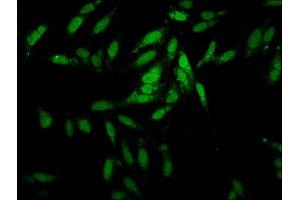 Immunofluorescence staining of Hela cells with ABIN7151937 at 1:100, counter-stained with DAPI. (ESRP2 Antikörper  (AA 615-720))