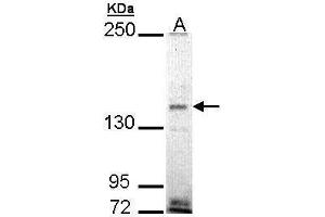 WB Image Sample (30 ug of whole cell lysate) A: H1299 5% SDS PAGE antibody diluted at 1:1000 (EHBP1 Antikörper)