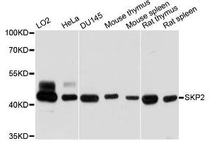 Western blot analysis of extracts of various cell lines, using SKP2 antibody. (SKP2 Antikörper  (AA 1-100))