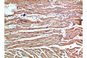 Immunohistochemical analysis of paraffin-embedded human-heart, antibody was diluted at 1:200