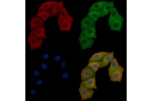 FAK Mouse Monoclonal Antibody staining Hela cells by IF/ICC.