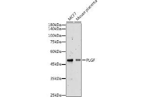 Western blot analysis of extracts of various cell lines, using PLGF antibody (ABIN7269385) at 1:500 dilution. (PLGF Antikörper)