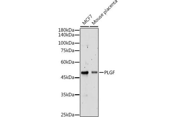 PLGF anticorps