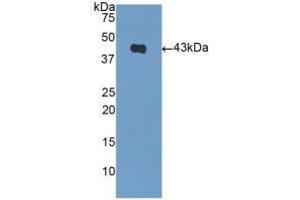 Detection of Recombinant NPPB, Mouse using Polyclonal Antibody to Natriuretic Peptide Precursor B (NPPB) (NPPB Antikörper  (AA 27-121))