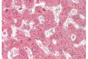 Rabbit Anti-DHODH antibody  Formalin Fixed Paraffin Embedded Tissue: Human Liver Primary antibody Concentration: 1:100 Secondary Antibody: Donkey anti-Rabbit-Cy3 Secondary Antibody Concentration: 1:200 Magnification: 20x Exposure Time: 0. (DHODH Antikörper  (N-Term))