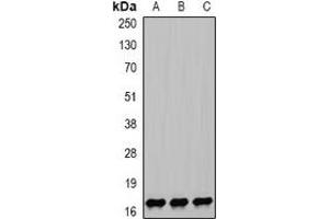 Western blot analysis of NPC2 expression in HEK293T (A), mouse lung (B), mouse liver (C) whole cell lysates.