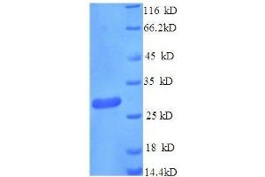 SDS-PAGE (SDS) image for Cathepsin K (CTSK) (AA 115-329) protein (His tag) (ABIN1609031)