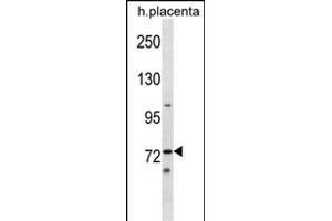 Mouse Sgk071 Antibody (N-term) (ABIN1539046 and ABIN2849427) western blot analysis in human placenta tissue lysates (35 μg/lane).