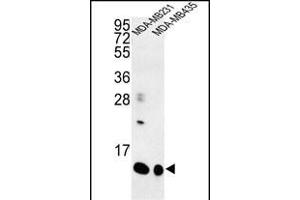 Western blot analysis of SPRR1B Antibody (C-term) (ABIN652994 and ABIN2842631) in MDA-M, MDA-M cell line lysates (35 μg/lane). (SPRR1B Antikörper  (C-Term))