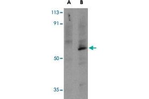 Western blot analysis of TRAF6 in PC-3 cell lysates with TRAF6 polyclonal antibody  at 1 ug/mL in the presence (A) or absence (B) of 1 ug blocking peptide. (TRAF6 Antikörper  (C-Term))