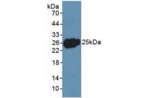 Western blot analysis of recombinant Human LIF. (LIF Antikörper  (AA 2-201))