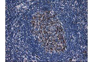 Image no. 5 for anti-Dihydrolipoamide Dehydrogenase (DLD) antibody (ABIN1497845) (DLD Antikörper)