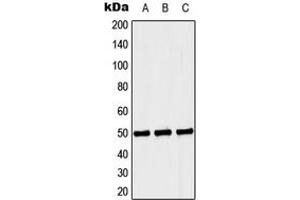 Western blot analysis of Septin 6 expression in Jurkat (A), NIH3T3 (B), PC12 (C) whole cell lysates. (Septin 6 Antikörper  (Center))