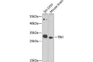 Western blot analysis of extracts of various cell lines, using TRH antibody (ABIN6130919, ABIN6149488, ABIN6149489 and ABIN6224343) at 1:1000 dilution. (TRH Antikörper  (AA 25-230))