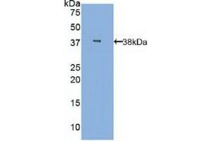 Detection of Recombinant MBL, Human using Polyclonal Antibody to Mannose Binding Lectin (MBL) (MBL2 Antikörper  (AA 42-96))