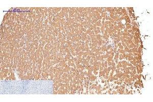 Immunohistochemistry of paraffin-embedded Human liver tissue using CD16 Monoclonal Antibody at dilution of 1:200. (CD16 Antikörper)