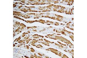 Immunohistochemistry (IHC) image for anti-Fatty Acid Binding Protein 3, Muscle and Heart (FABP3) (AA 119-133), (C-Term) antibody (ABIN3042627)