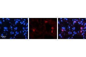 Immunohistochemistry (IHC) image for anti-Nuclear Factor of Activated T-Cells, Cytoplasmic, Calcineurin-Dependent 4 (NFATC4) (N-Term) antibody (ABIN2780606)