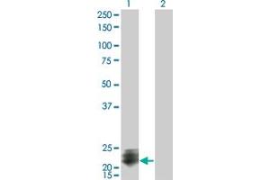 Western Blot analysis of STMN2 expression in transfected 293T cell line by STMN2 monoclonal antibody (M07), clone 2G7. (STMN2 Antikörper  (AA 73-179))