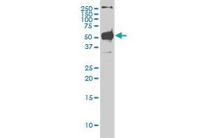 Western Blotting (WB) image for anti-serine/threonine Kinase 38 (STK38) (AA 1-466) antibody (ABIN599179) (STK38 Antikörper  (AA 1-466))