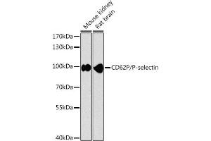 Western blot analysis of extracts of various cell lines, using CD62P/P-selectin antibody (ABIN6131513, ABIN6147502, ABIN6147505 and ABIN6216165) at 1:1000 dilution. (P-Selectin Antikörper  (AA 220-319))