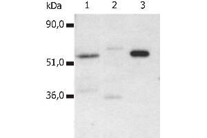 Immunoprecipitation of human CD4 from the lysate T cells isolated from fresh buffy coats. (CD4 Antikörper)