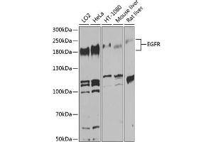 Western blot analysis of extracts of various cell lines, using EGFR antibody (ABIN6133679, ABIN6139975, ABIN6139980 and ABIN6215265) at 1:1000 dilution. (EGFR Antikörper  (AA 960-1060))