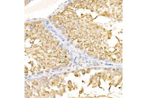 Immunohistochemistry of paraffin-embedded rat testis using KIF3A Rabbit pAb (ABIN6128170, ABIN6142871, ABIN6142872 and ABIN6222335) at dilution of 1:500 (40x lens). (KIF3A Antikörper  (AA 430-699))
