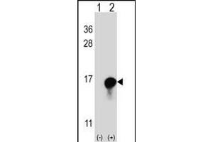 Western blot analysis of FKBP1A (arrow) using rabbit polyclonal FKBP1A Antibody (C-term) (ABIN1882082 and ABIN2841885). (FKBP1A Antikörper  (C-Term))