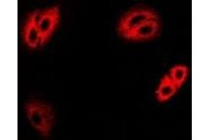 Immunofluorescent analysis of IRBP staining in MCF7 cells. (RBP3 Antikörper)