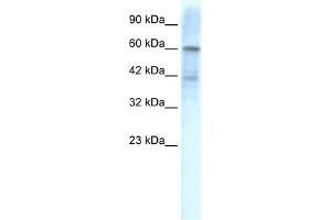 KCND3 antibody used at 1. (KCND3 Antikörper  (Middle Region))