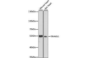 Western blot analysis of extracts of various cell lines, using TINAGL1 antibody (ABIN6293721) at 1:3000 dilution.