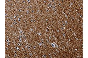 The image on the left is immunohistochemistry of paraffin-embedded Human brain tissue using ABIN7191804(PCDHAC1 Antibody) at dilution 1/50, on the right is treated with synthetic peptide. (PCDHAC1 Antikörper)