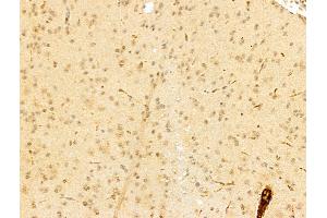 ABIN7094250 and ABIN7098297 at 1/100 staining Mouse brain tissue by IHC-P. (GAS7 Antikörper  (Internal Region))