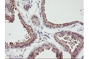 Immunohistochemistry (IHC) image for anti-Excision Repair Cross Complementing Polypeptide-1 (ERCC1) antibody (ABIN1498065) (ERCC1 Antikörper)