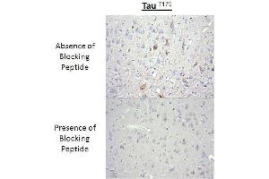 Immunohistochemistry analysis of a competition assay demonstrating the specificity of the anti-Tau (Thr-175) antibody (tau Antikörper  (pThr175))
